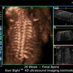 26 sav. vaisiaus stuburas 3/4 D nėščiųjų echoskopija